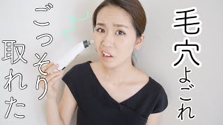 【閲覧注意】毛穴吸引器を使ったら汚れ取れまくり…